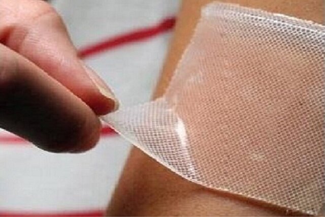 عکس تزئینی است فراخوان پژوهشی دستیابی به دانش فنی زخمپوشهای هیدروژل تزریقی
