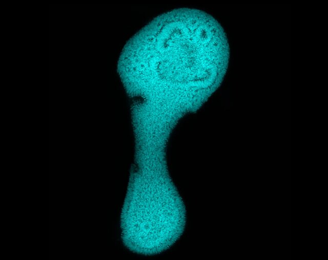 ۱۲ اثر شگفتانگیز از فینالیستهای مسابقه تصاویر میکروسکوپی