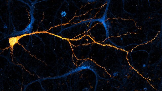 ۱۲ اثر شگفتانگیز از فینالیستهای مسابقه تصاویر میکروسکوپی