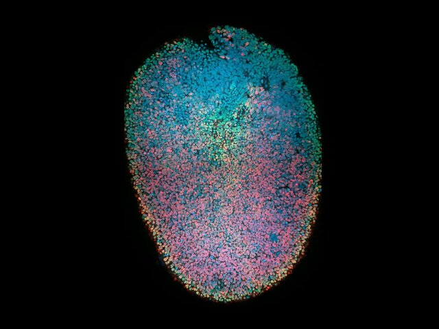 ۱۲ اثر شگفتانگیز از فینالیستهای مسابقه تصاویر میکروسکوپی