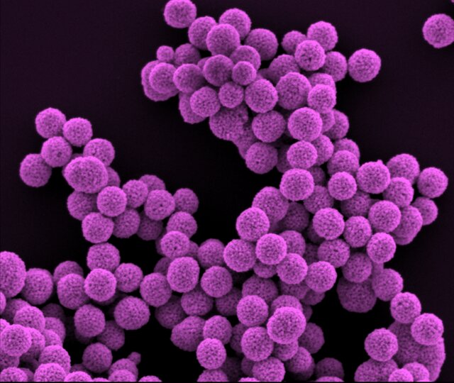 ۱۲ اثر شگفتانگیز از فینالیستهای مسابقه تصاویر میکروسکوپی