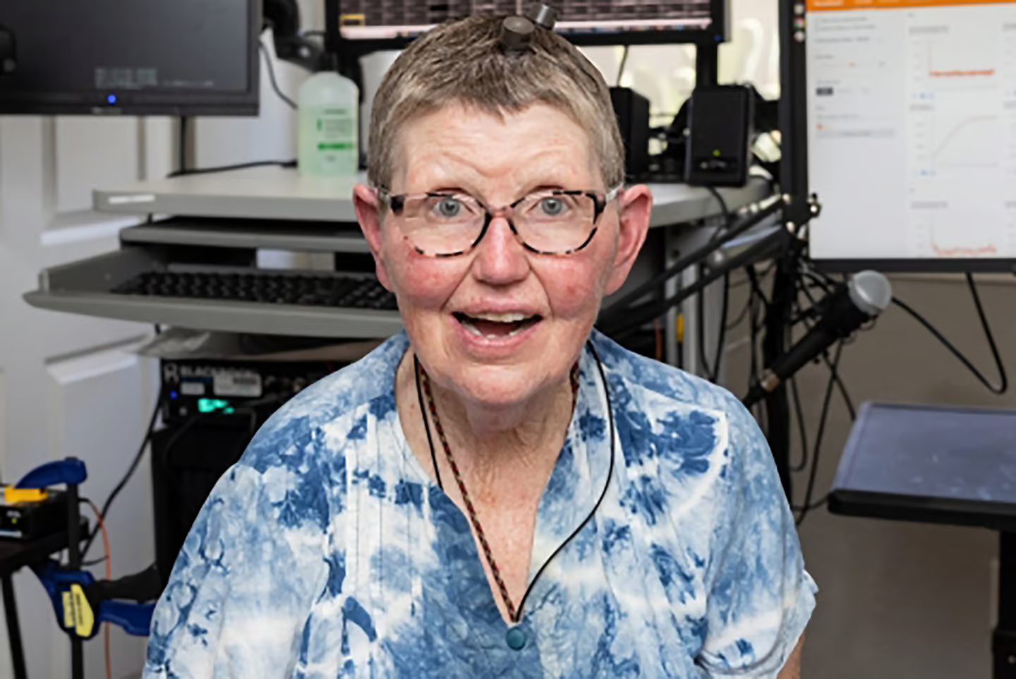 بازیابی قدرت تکلم دو زن با رابط مغز و رایانه