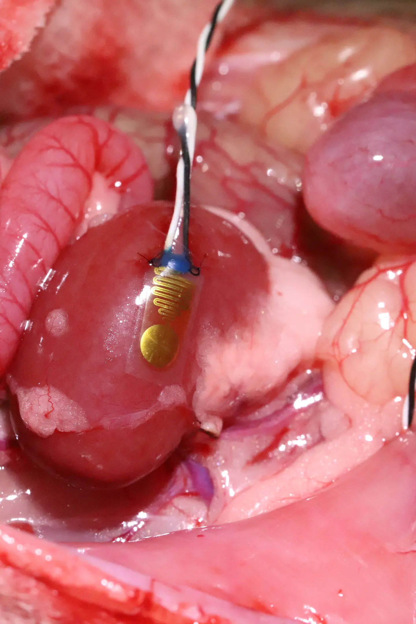 اولین دستگاه جهان برای نظارت لحظهای بر اعضای پیوندی