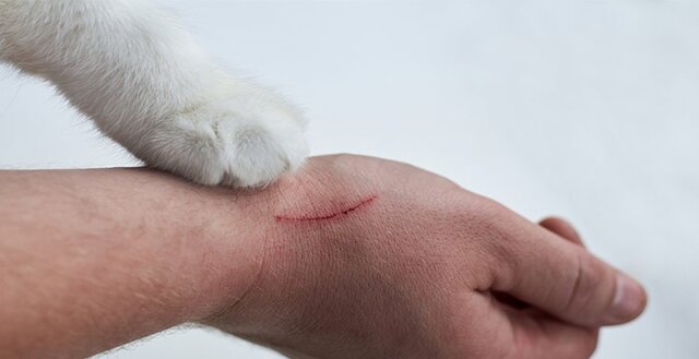 با هاری چه کنیم؟