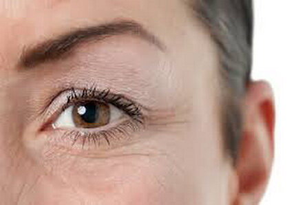 عکس تزیینی است. چین و چروکهای صورت درباره کدام بیماریها هشدار میدهند؟