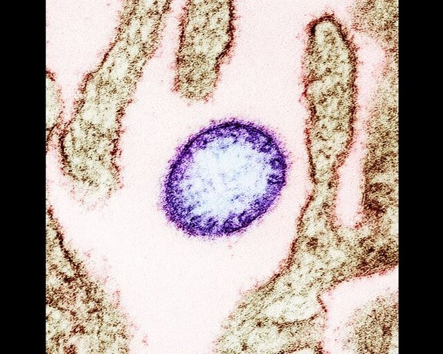 ویروسی با پتانسیل همهگیری