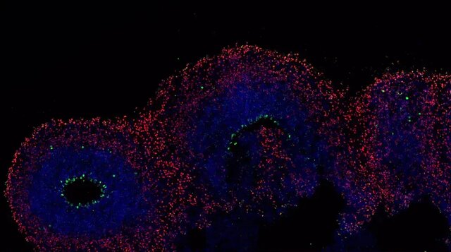 ارگانوئیدها میتوانند آینده پزشکی را متحول کنند