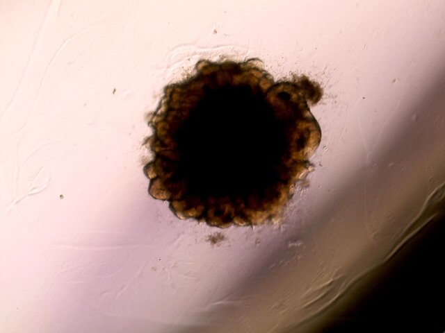 ارگانوئیدها میتوانند آینده پزشکی را متحول کنند