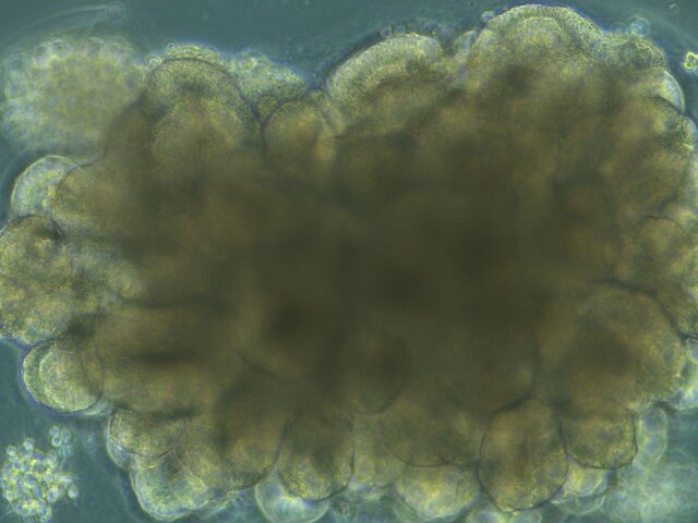 ارگانوئیدها میتوانند آینده پزشکی را متحول کنند