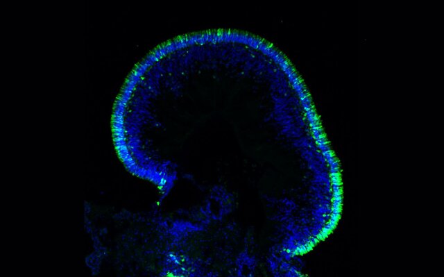 ارگانوئیدها میتوانند آینده پزشکی را متحول کنند