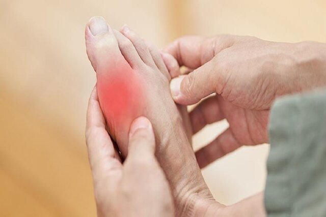 درمان نقرس و بیماری قلبی با داروی سرطان درمان نقرس و بیماری قلبی با داروی سرطان