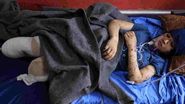 روز جهانی کودک و کودکان غزه؛ رویاهایی که زیر آوارها دفن میشود
