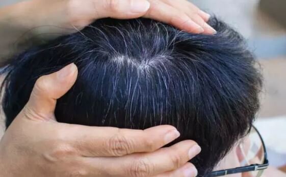 یافتهای جدید درباره سفید شدن مو یافتهای جدید درباره سفید شدن مو