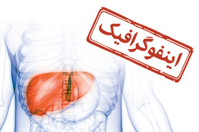 اینفوگرافیک/ ۶ عامل خاموش بروز سرطان کبد