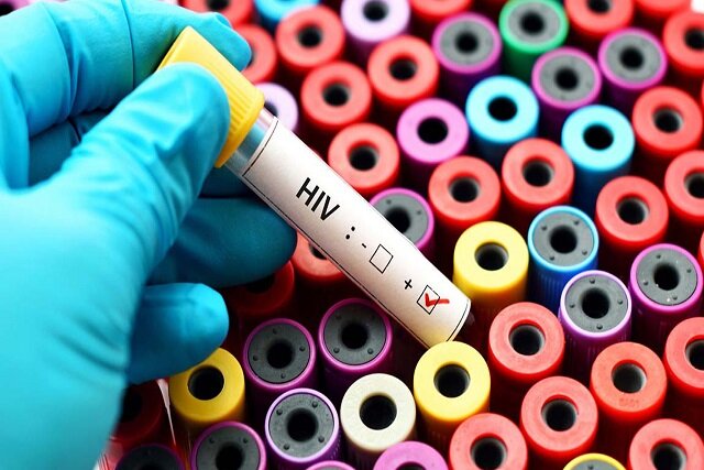 داروهای HIV خطر انتقال ایدز را تقریباً به صفر میرسانند داروهای HIV خطر انتقال ایدز را تقریباً به صفر میرسانند