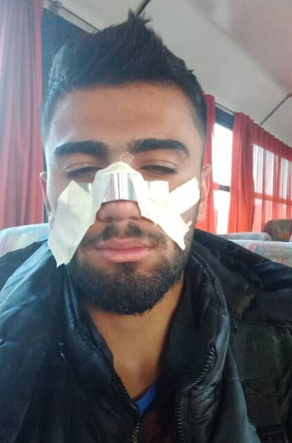 بازیکن مصدوم نفت مسجدسلیمان جریان درگیری در بازی تیم امید نفت مسجدسلیمان و تراکتور چه بود؟