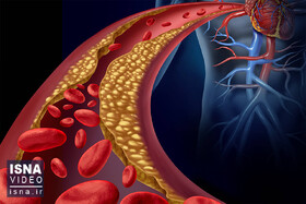 ویدیو/ درمان کلسترول خون با یک واکسن جدید