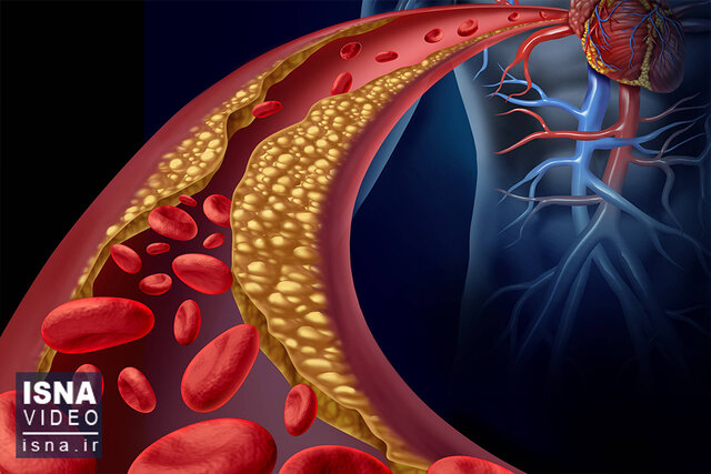 ویدیو/ درمان کلسترول خون با یک واکسن جدید ویدیو/ درمان کلسترول خون با یک واکسن جدید