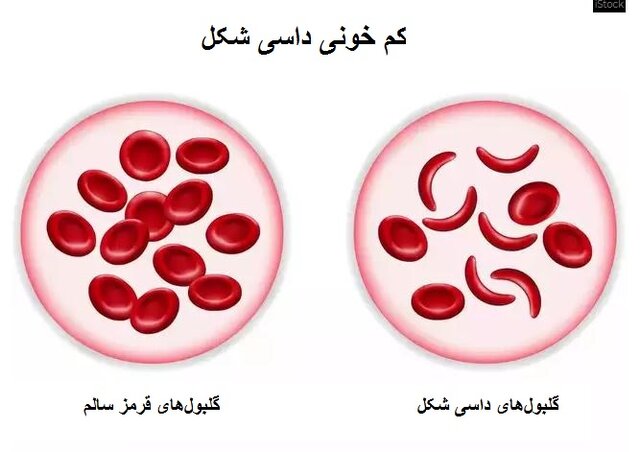 چند دستاورد مهم پزشکی در ۲۰۲۳