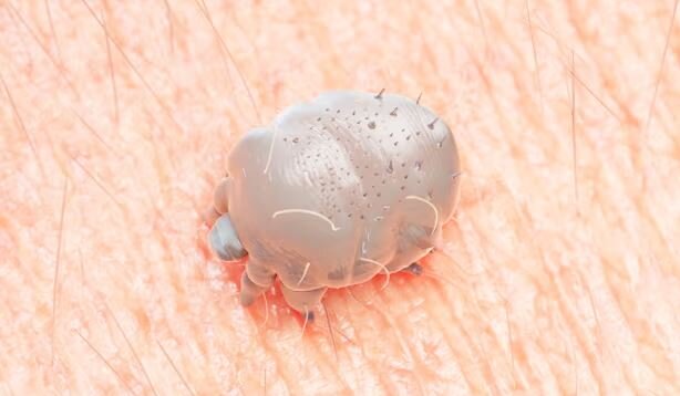 شیوع یک بیماری واگیردار در انگلیس؛ متخصصان نگران کمبود دارو هستند