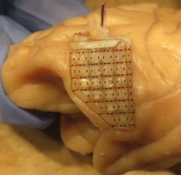 پیشگیری از اعتیاد به قمار با کاشت یک تراشه در مغز!