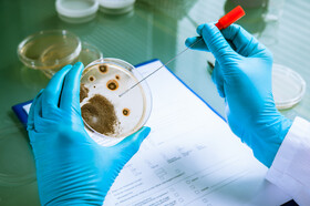 کارگاه «کنترل کیفی در بخش میکروب‌شناسی آزمایشگاه بالینی»