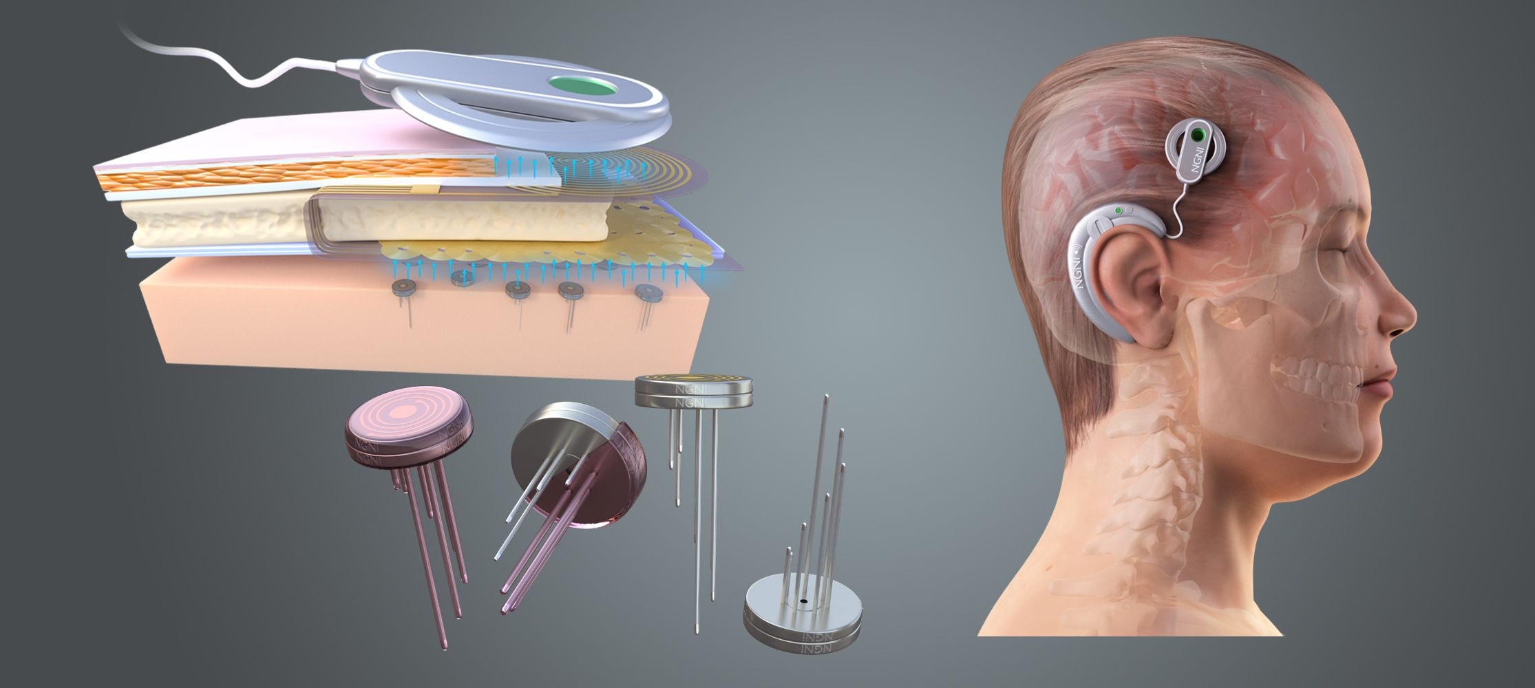 هر آنچه باید در مورد فناوریهای ذهنخوانی بدانید