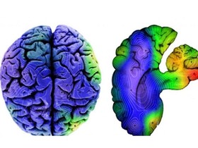 معرفی پایگاه‌های داده تصویربرداری مغز