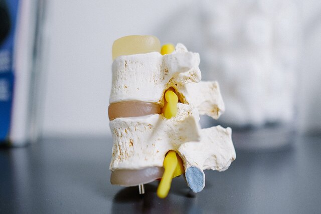 کشف یک مکانیسم بیولوژیکی که میتواند به کمر درد مزمن پایان دهد