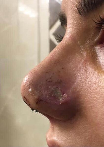 کاهش سن جراحیهای زیبایی به ۱۴ سال / افزایش تقاضا در مردان و کهنسالان