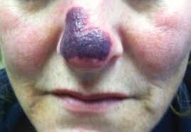 کاهش سن جراحیهای زیبایی به ۱۴ سال / افزایش تقاضا در مردان و کهنسالان