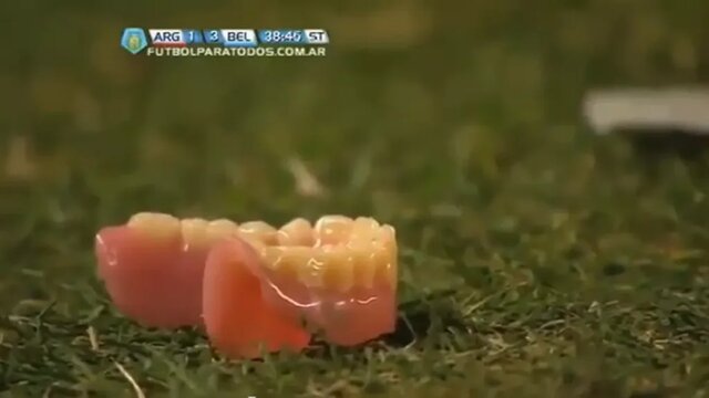 عجیبترین اتفاقات تاریخ فوتبال؛ از افتادن دندان مصنوعی داور تا حمله هواداران با کلم!