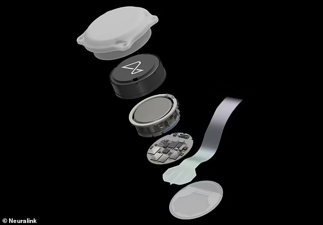 ایلان ماسک میگوید اولین دریافتکننده تراشه نورالینک ماوس را با فکر کنترل میکند