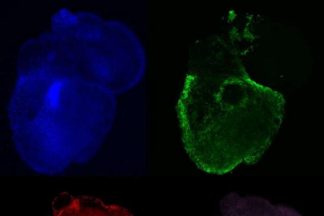 دستیابی پژوهشگران به قلب‌های مصنوعی واقعی‌تر