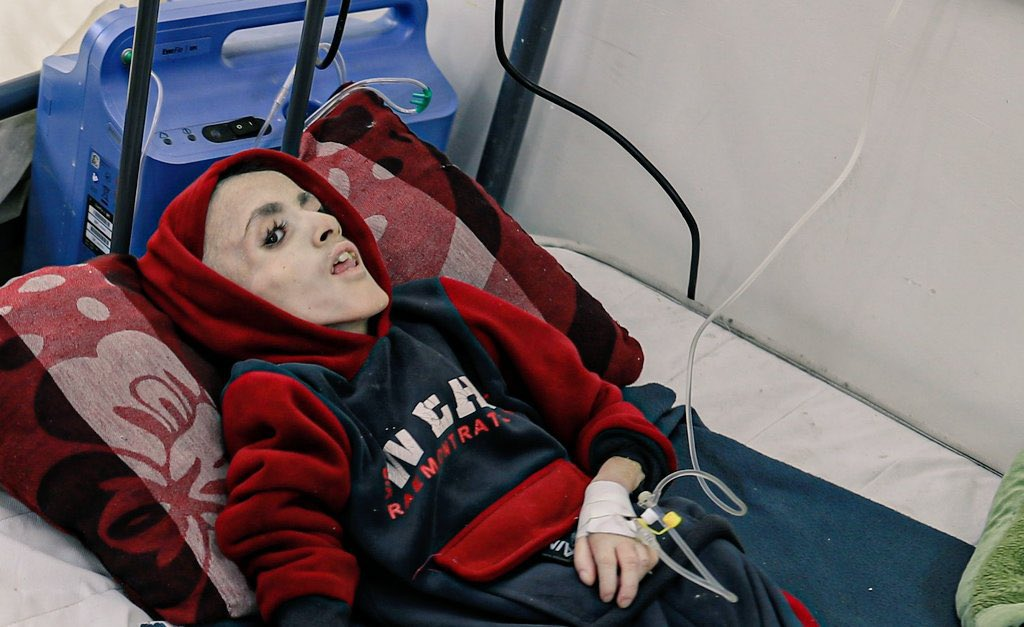 سیاست گرسنگی همچنان از کودکان غزه جان میگیرد