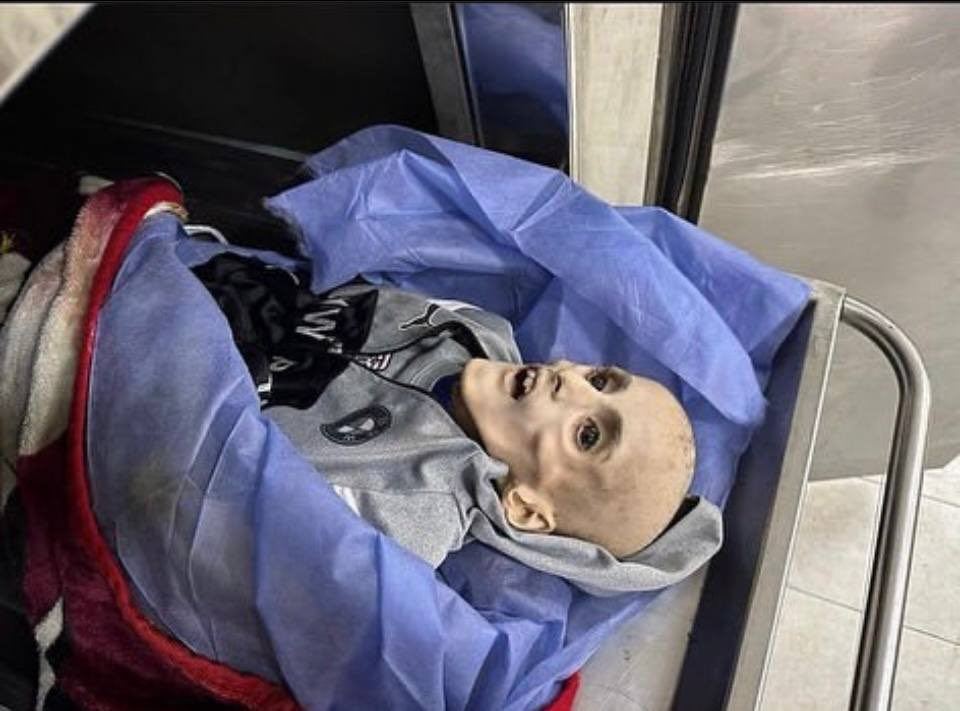 سیاست گرسنگی همچنان از کودکان غزه جان میگیرد