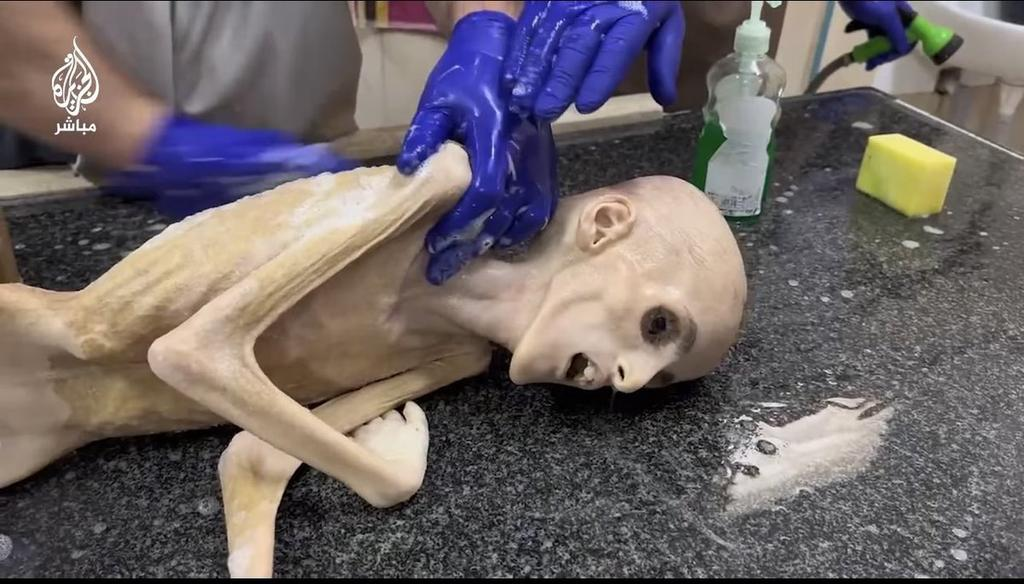 سیاست گرسنگی همچنان از کودکان غزه جان میگیرد