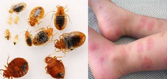 سمهای کشنده مخصوص ساس