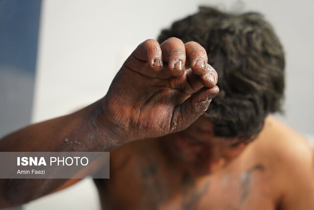 عکس آرشیوی است. ۱۷ فوتی و ۳۰۵ قطع عضو در چهارشنبهسوری ۱۴۰۲/بیشترین آمار مصدومیت در زیر ۱۸ سالهها