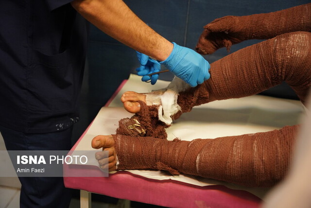 عکس خبر تزئینی است ۱۱ مصدوم در حوادث چهارشنبه آخر سال کهگیلویه و بویراحمد