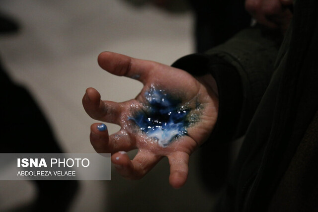 عکس آرشیوی است ٣ جوان بر اثر انفجار مواد منفجره در یزد مصدوم شدند