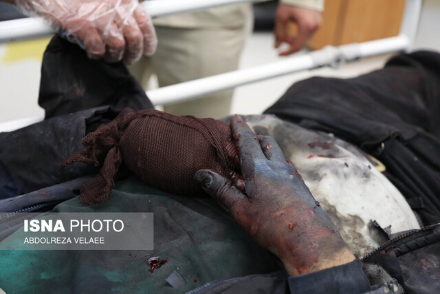 عکس آرشیوی است. ابلاغ دستورالعمل ارائه خدمات درمانی به مصدومین احتمالی چهارشنبه سوری