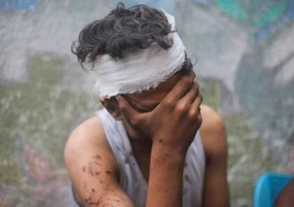 دهها فلسطینی منتظرِ دریافت کمک در غزه به ضرب گلوله اشغالگران شهید و زخمی شدند