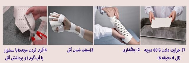 تولید آتلهای منعطف و هوشمند با قابلیت سفتشدن در ۵ دقیقه