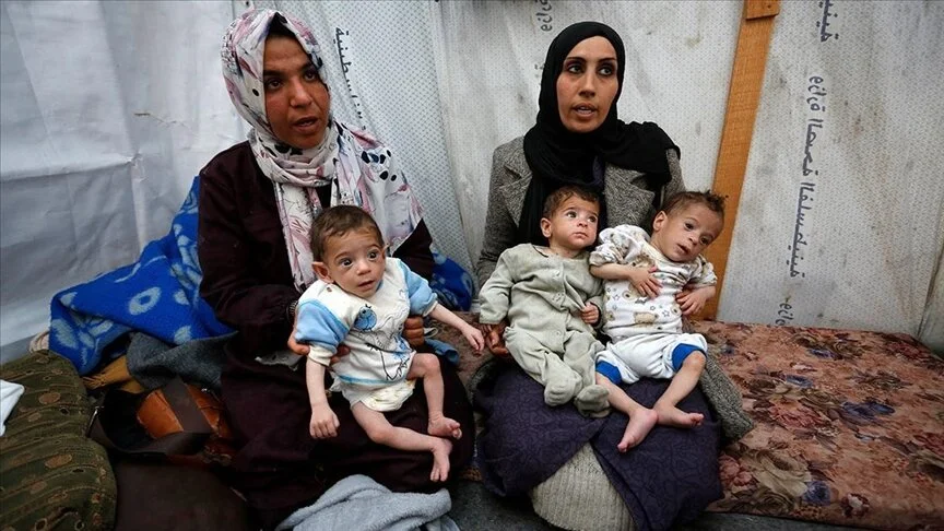 سازمان ملل: قحطی و سوءتغذیه در غزه بی‌داد می‌کند