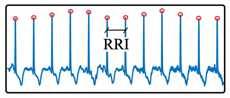 ساعت هوشمندی که اختلال در ریتم قلب را زودتر از وقوع پیش‌بینی می‌کند
