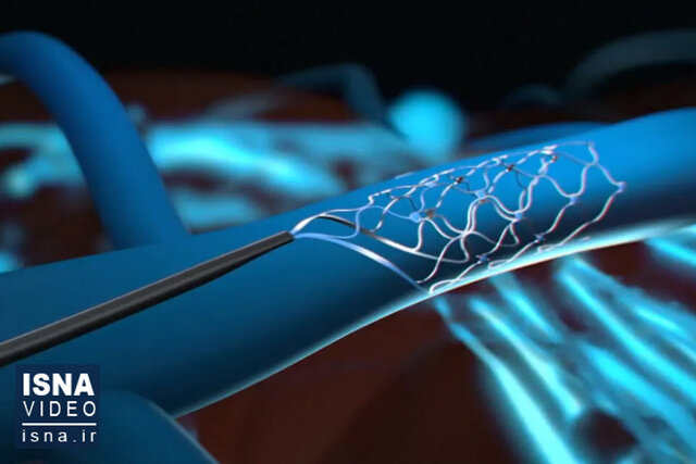 ویدیو/ تراشهای جدید که محدودیتهای معلولان را رفع میکند ویدیو/ تراشهای جدید که محدودیتهای معلولان را رفع میکند