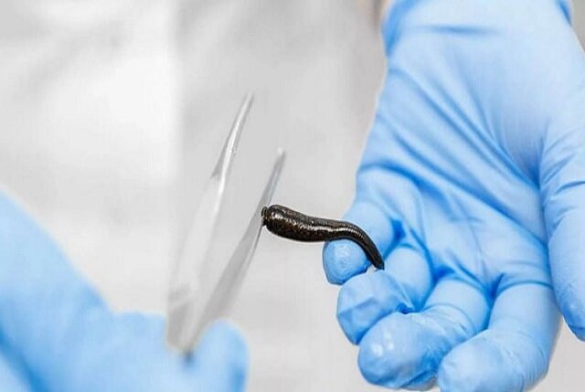 زالودرمانی زالو درمان میکند؟