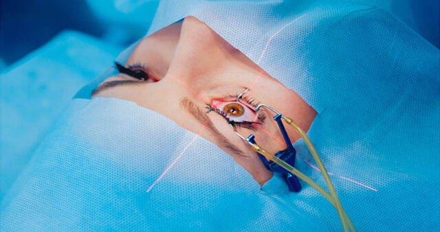 راهاندازی دستگاه لیزیک برای اولین بار در خراسان جنوبی  راهاندازی دستگاه لیزیک برای اولین بار در خراسان جنوبی