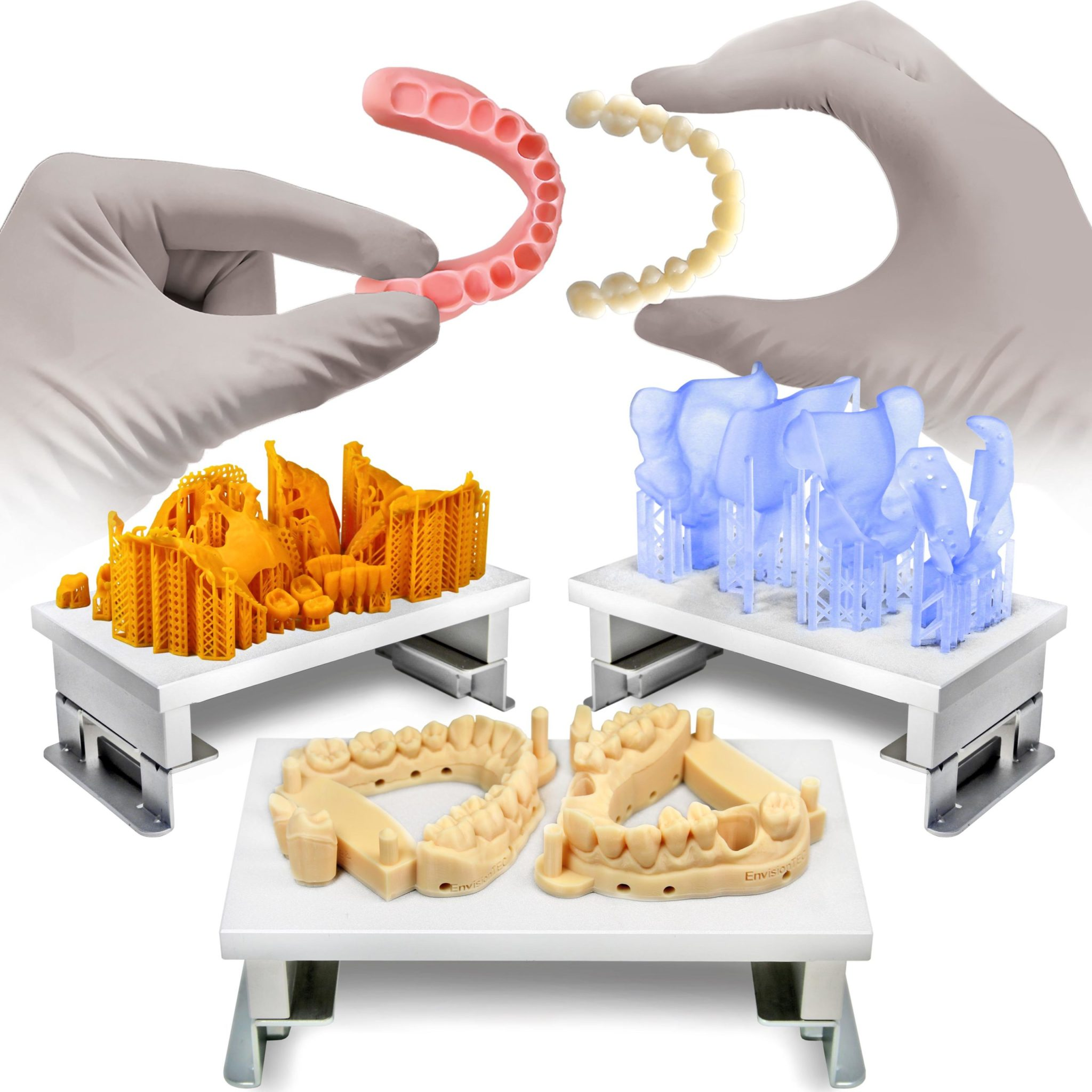 شروع دندانپزشکی دیجیتال با اسکنر داخل دهانی، میلینگ و پرینتر دندانسازی بومی